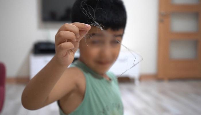 3 yıl sonra ortaya çıktı: 18 santimetre Catharers unuttu! Salatalık yuttuğunda ortaya çıktı