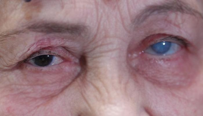 Sisler parlak hale geldi! Resmi olarak ikinci kez gözlerini canlandırdı …