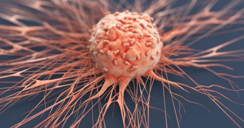 Kanserde Büyük Başarı: Bazı türlerde iyileşme oranı arttı